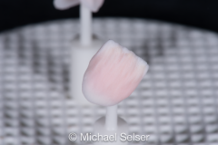 Porcelain Buildup Crown